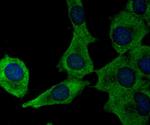 Ferritin Heavy Chain Antibody in Immunocytochemistry (ICC/IF)