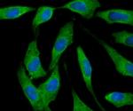 Ferritin Heavy Chain Antibody in Immunocytochemistry (ICC/IF)