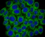 SMYD3 Antibody in Immunocytochemistry (ICC/IF)