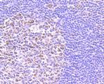 SMYD3 Antibody in Immunohistochemistry (Paraffin) (IHC (P))