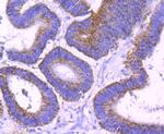 SMYD3 Antibody in Immunohistochemistry (Paraffin) (IHC (P))