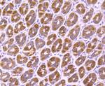 SMYD3 Antibody in Immunohistochemistry (Paraffin) (IHC (P))