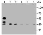 SMYD3 Antibody in Western Blot (WB)