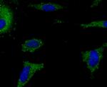 IBA1 Antibody in Immunocytochemistry (ICC/IF)