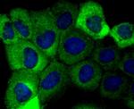 Aldolase A Antibody in Immunocytochemistry (ICC/IF)