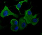 Aldolase A Antibody in Immunocytochemistry (ICC/IF)