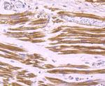 Aldolase A Antibody in Immunohistochemistry (Paraffin) (IHC (P))