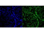 Histone H2A.X Antibody in Immunohistochemistry (Paraffin) (IHC (P))