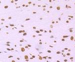 Histone H2A.X Antibody in Immunohistochemistry (Paraffin) (IHC (P))