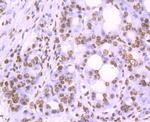 Histone H2A.X Antibody in Immunohistochemistry (Paraffin) (IHC (P))