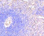 N-WASP Antibody in Immunohistochemistry (Paraffin) (IHC (P))