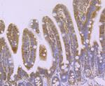 N-WASP Antibody in Immunohistochemistry (Paraffin) (IHC (P))