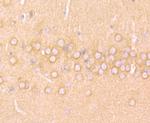 N-WASP Antibody in Immunohistochemistry (Paraffin) (IHC (P))