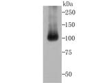 ALDH1L1 Antibody in Western Blot (WB)