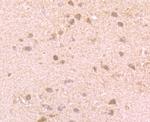 GIT1 Antibody in Immunohistochemistry (Paraffin) (IHC (P))