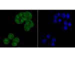 CRM1 Antibody in Immunocytochemistry (ICC/IF)