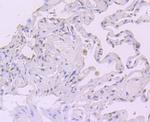 CRM1 Antibody in Immunohistochemistry (Paraffin) (IHC (P))