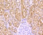 PCK2 Antibody in Immunohistochemistry (Paraffin) (IHC (P))