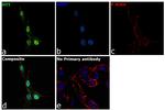 Huntingtin Antibody in Immunocytochemistry (ICC/IF)