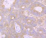 Huntingtin Antibody in Immunohistochemistry (Paraffin) (IHC (P))