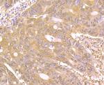 PAK2 Antibody in Immunohistochemistry (Paraffin) (IHC (P))