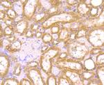 PAK2 Antibody in Immunohistochemistry (Paraffin) (IHC (P))