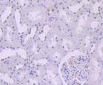 SMARCB1 Antibody in Immunohistochemistry (Paraffin) (IHC (P))