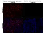 Arginase 1 Antibody