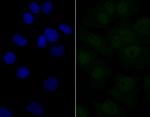 eIF4A3 Antibody in Immunocytochemistry (ICC/IF)