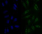 eIF4A3 Antibody in Immunocytochemistry (ICC/IF)