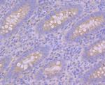 PUM1 Antibody in Immunohistochemistry (Paraffin) (IHC (P))