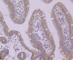 PUM1 Antibody in Immunohistochemistry (Paraffin) (IHC (P))