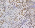 alpha Actinin 2 Antibody in Immunohistochemistry (Paraffin) (IHC (P))