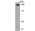 alpha Actinin 2 Antibody in Western Blot (WB)