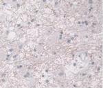 ORM1 Antibody in Immunohistochemistry (Paraffin) (IHC (P))