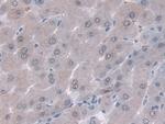 ORM1 Antibody in Immunohistochemistry (Paraffin) (IHC (P))