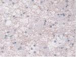 ORM1 Antibody in Immunohistochemistry (Paraffin) (IHC (P))