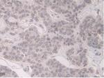 ORM1 Antibody in Immunohistochemistry (Paraffin) (IHC (P))