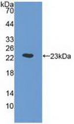 ORM1 Antibody in Western Blot (WB)