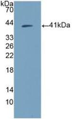 Amphiregulin Antibody in Western Blot (WB)