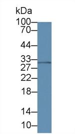 Amphiregulin Antibody in Western Blot (WB)