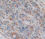 Amphiregulin Antibody in Immunohistochemistry (Paraffin) (IHC (P))