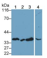 Annexin V Antibody in Western Blot (WB)