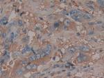 Antithrombin Antibody in Immunohistochemistry (Paraffin) (IHC (P))