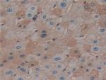 Antithrombin Antibody in Immunohistochemistry (Paraffin) (IHC (P))