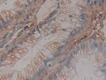 Antithrombin Antibody in Immunohistochemistry (Paraffin) (IHC (P))