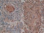 Antithrombin Antibody in Immunohistochemistry (Paraffin) (IHC (P))