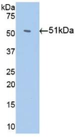 Antithrombin Antibody in Western Blot (WB)