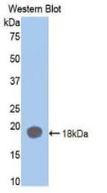 Prothrombin Antibody in Western Blot (WB)