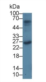 Prothrombin Antibody in Western Blot (WB)